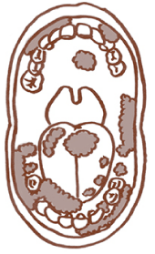 食べものが口の中に残る